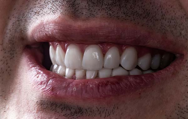 Close-up of a man's bright smile.